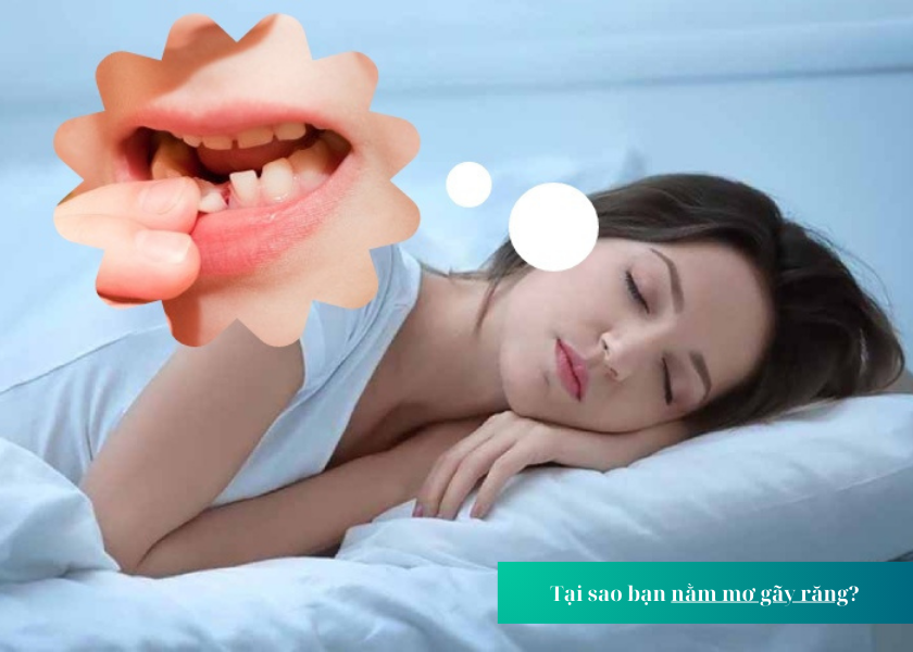 Giải Mã Giấc Mơ Rụng Răng: Cơ Hội Thay Đổi Vận Mệnh Cùng Go88