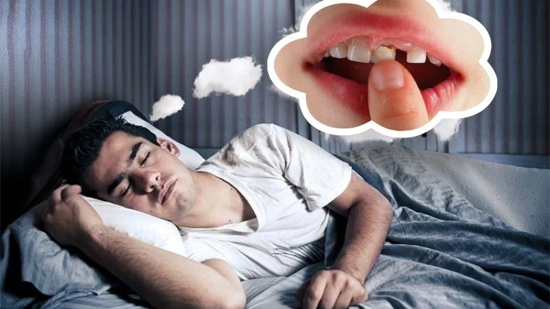 Giải Mã Giấc Mơ Rụng Răng: Cơ Hội Thay Đổi Vận Mệnh Cùng Go88